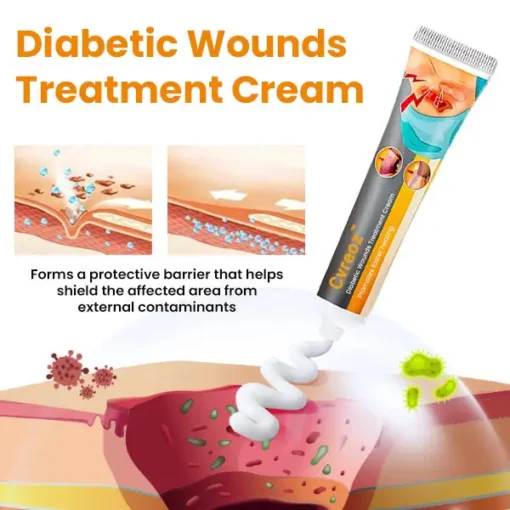 Cvreoz™ Diabetic Wounds Treatment Cream