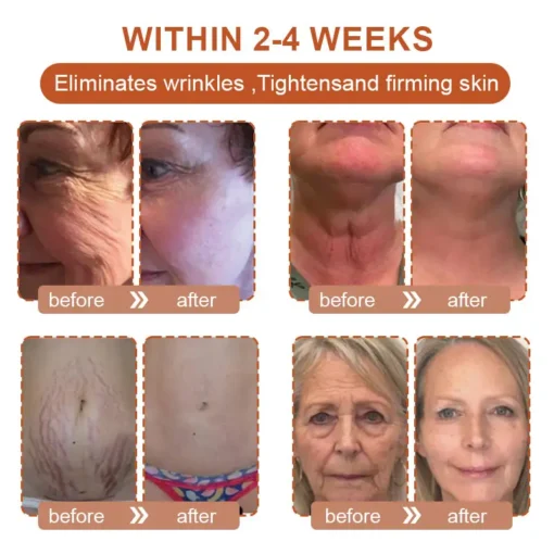 Flysmus™ BotoxBee Wrinkle Removal Cream - Image 3