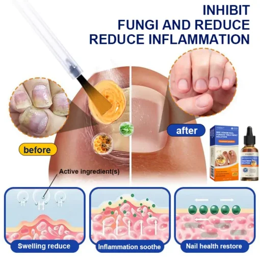 Furzero™ Bee Venom Nail Fungus Treatment Solution - Image 3