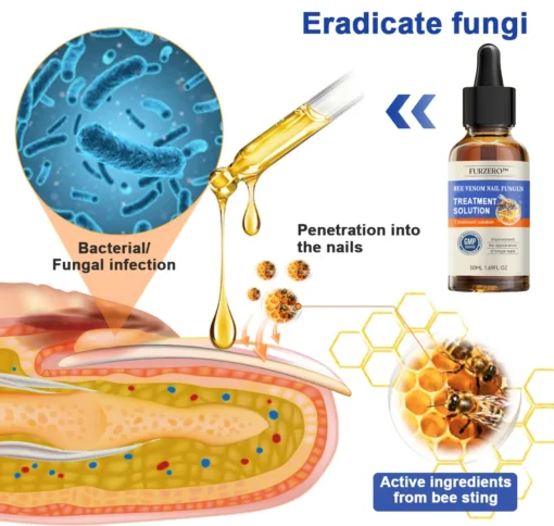 Furzero™ Bee Venom Nail Fungus Treatment Solution - Image 5