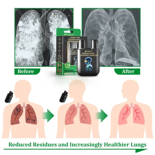 Ourlyard™ Herbal Lung Cleansing Inhaler