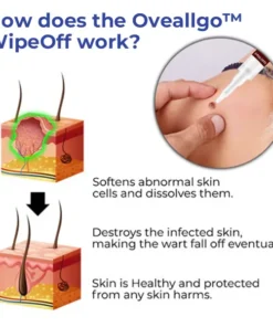 Oveallgo™ WipeOff Tags & Moles Remover