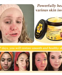 VLSVLS™ Bee Venom Skin Restoration Cream